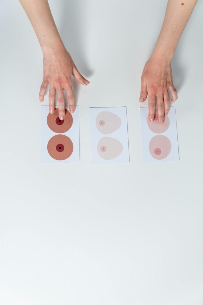 Breast Explant San Antonio