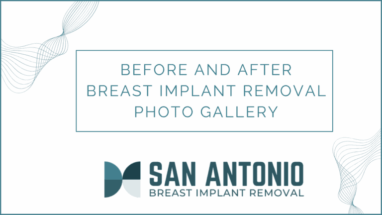 Breast Implant Removal Before After Gallery