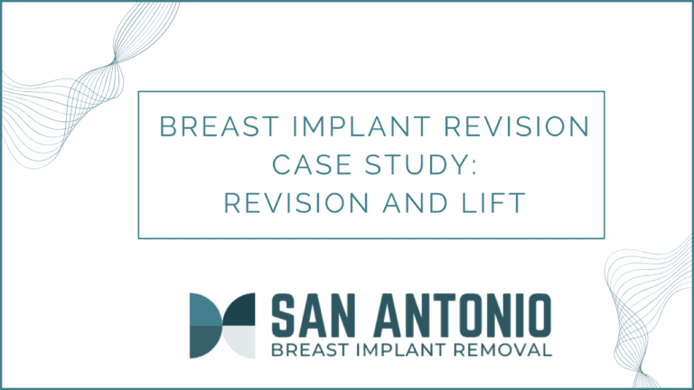 Revision and Lift Case Study