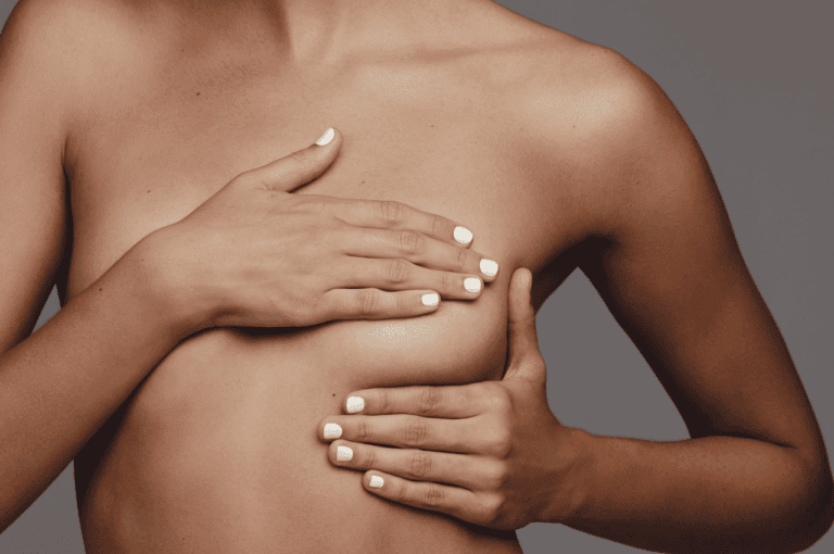 breast implant removal scars