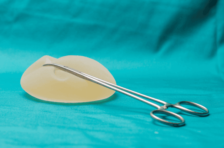 does insurance cover breast implant removal